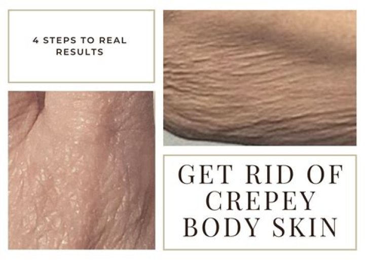 6 Tips to Get Rid of Crepey Skin, According to Beauty Experts and Dermatologists