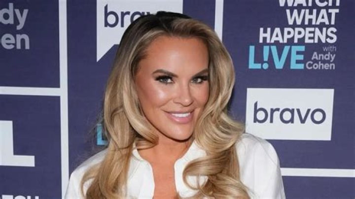 Did Heather Gay Get New Teeth?