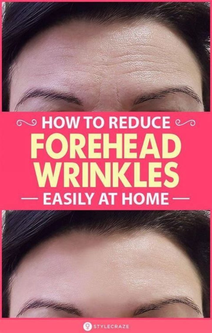 How to Get Rid of Forehead Wrinkles: 18 Dermatologist-Approved Tips