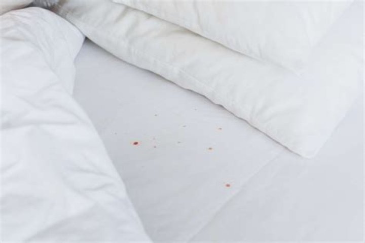 If Your Sheets Are This Color, They Could Be Attracting Bed Bugs, Experts Say — Best Life
