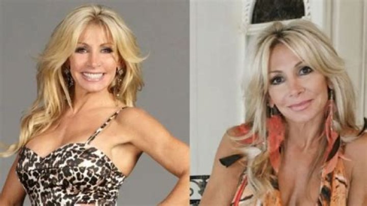 Is Suzette Snider Relying On Cosmetic Enhancement To Retain Her Youthful Beauty?