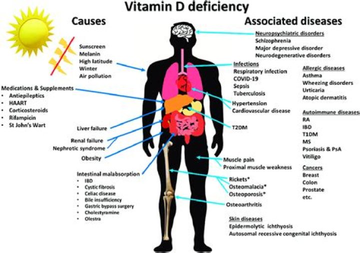 20 Symptoms of Vitamin D Deficiency, According to Medical Experts — Best Life